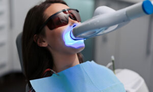 teeth whitening